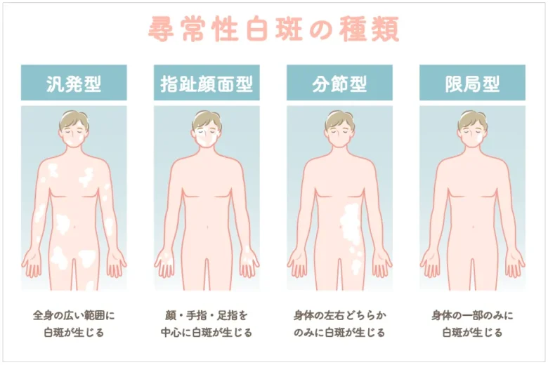 hiroki-itou